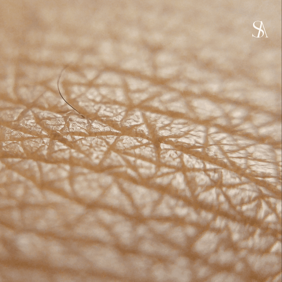 Advances in 3D Bioprinting for Skin Tissue Engineering